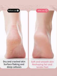 Rechargeable Electric Foot Grinder, Electric Foot Grinder, Four Replaceable Grinding Heads, Portable And Easy To Use, USB Charging, Suitable For Dry And Cracked Soles, Ideal Gift For Parents - Multicolor - View 3