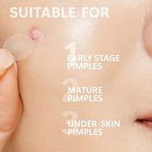 24/12pcs Blemish, Scar, Acne Cover Patches, Hydrocolloid Material With Tea Tree Oil & Premium Essence, Comfortable Breathable Gentle Non-Irritating - White - View 7