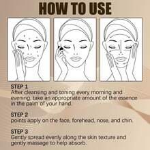 Lactic Acid Facial Serum, Facial Essence For Autumn & Winter, Moisturizing & Hydrating. Contains Witch Hazel & Ceramide. Helps Tighten Pores, Smooth & Refine Skin, Cleanse Blackheads & Blemishes - White - View 5