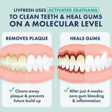 LIVFRESH Toothpaste Gel, Clinically Proven To Remove Plaque 250% Better, Improves Gum 190% Better, Prevents & Reduces Tartar, Freshens Breath, SLS Dental Gel, Wintergreen - 淡薄荷味,無色素,無泡沫 - 查看 9