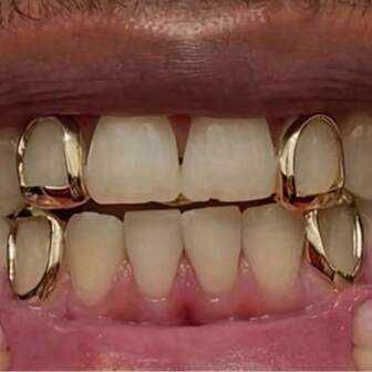 1/2/4 قطعة من الأسنان المعدنية المجوفة الهيب هوب، إكسسوار مسرحي جنسي محايد، هدية عيد