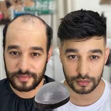 Hair Toupee Full PU Thin Skin Base 13*18 Cm Men Hair Toupee Npu Hair Patch For Men Thin PU Toupee Topper Mens Human Hair Hairpiece Replacement System Men Hair Tropper, Natural Black Short Men Topper Wig Real Human Hair - Natural Black - 查看 1