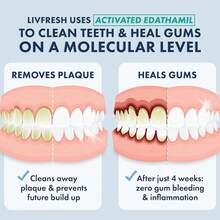LIVFRESH Toothpaste Gel, Clinically Proven To Remove Plaque 250% Better, Improves Gum 190% Better, Prevents & Reduces Tartar, Freshens Breath, SLS Dental Gel, Wintergreen - 淡薄荷味,無色素,無泡沫 - 查看 2