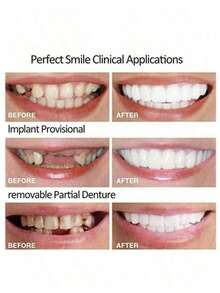 Bộ 2 miếng niềng răng thẩm mỹ Instant Smile, mặt dán sứ trên và dưới dành cho nam và nữ, dễ dàng lắp đặt, không cần dùng lực, hoàn hảo cho trang phục thường ngày - trắng - Xem 5