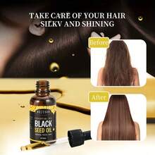 MEJISOO Black Seed Hair Oil, Cold-Pressed Essential Oil With Black Cumin Seed Oil, Monk Bread Fruit Oil, Rosemary Oil, 30ml/1.01fl Oz, Suitable For Scalp/Hair/Facial Care, Triple Effect - Multi Scents - View 5