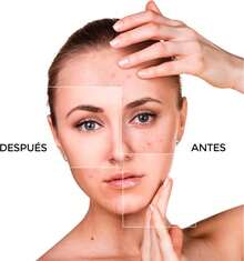 kit removedor de espinillas y puntos negros - Set de 8 Herramientas de Acero Inoxidable para Extraer Espinillas y Granos - Sacacomedones para Limpieza y Cuidado Facial - 1 - Ver 1