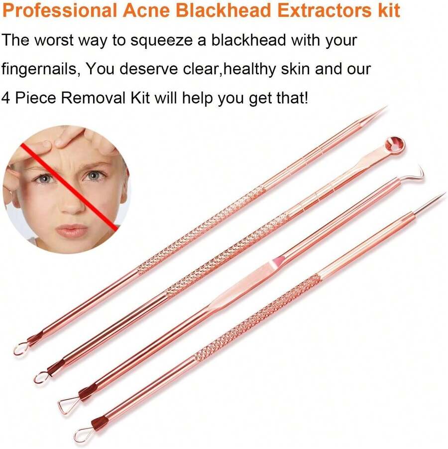 Set de Acero Inoxidable Espinilla Acné Blemish Eliminación de la espinilla Kit de Aguja Herramienta para Mujeres y Hombres cuidado Facial de la Piel Protegerï¼ˆ4 pcsï¼‰ - 1 - Ver 1