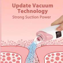 便携式电动黑头真空吸黑头仪套装，可去除黑头和白头，面部及皮肤护理设备，400mAh - 粉色 - 查看 10