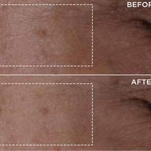 Double Serum Anti-Aging + Anti-Wrinkle Serum 1.7 OZ/50 ML Duo, Visibly Firms Smoothes Boosts Radiance Refines Pores 24H Hydration All Skin Types Girlfriend Wife Mother Friend Birthday Graduation Party Travel Camping Outdoors School Campus Trip Festivals Anniversary, Gift Valentine's Day Halloween Thanksgiving Christmas New Year's Day - 金色 - 查看 6