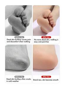 1 pieza Removedor de callosidades Pro 3 en 1 - Lima de acero inoxidable para pies y cepillo limpiador de dedos para piel muerta, talones duros y agrietados | Herramienta de pedicura para pies suaves y limpieza profunda | Regalo