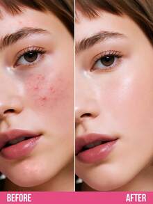 Misslyn مخفي MISSLYN-SHOT IT LOUD! ، مخفي سائل ، يوحد لون البشرة ، مخفي مع صبغات عاكسة للضوء ومركب مرطب ، مخفي متعدد الاستخدامات ، خفيف الوزن ، تغطية كاملة ، طويل الأمد ، مرطب ، يبرز ، قوام كريمي ، مقاوم للماء ، طويل الأمد ، لا يترك بقع ، قوام كريمي ، طويل الأمد ، تغطية كاملة ، أساس سائل ، يغطي البثور والتصبغات ، مغذي ومنير ، مكياج حفلة Y2K ، عطلة