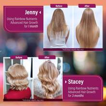 Hair Growth Vitamins For Women | Biotin 10,000mcg, Collagen, Patented OptiMSM, GoMCT, Saw Palmetto | Naturally Regrow Stronger & Healthier Hair, Skin And Nails | Stops Hair Loss | 60 Day Supply - 3瓶 - 查看 4