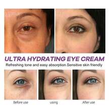 EELHOE Hydrating Eye Cream Tighten Eye Contour Eliminates Puffiness Dark Spots Anti Dark Circle Reduce Eyes Bag Fade Fine Lines Wrinkles Brightening Eye Skin Care Products - 白色 - 查看 7