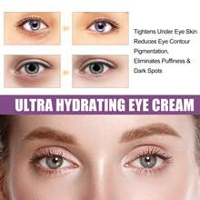 EELHOE Hydrating Eye Cream Tighten Eye Contour Eliminates Puffiness Dark Spots Anti Dark Circle Reduce Eyes Bag Fade Fine Lines Wrinkles Brightening Eye Skin Care Products - 白色 - 查看 4
