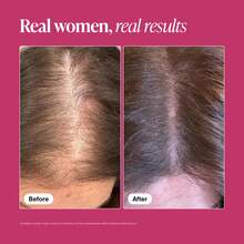GWYNNE Viviscal Hair Growth Supplements For Women, Helps Achieve Thicker And Fuller Hair In Cases Of Thinning Hair And Hair Loss, With Biotin And Marine Collagen, Drug-Free, 180 Tablets. - 其他 - 查看 3