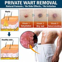 Bolígrafo portátil y ligero de luz azul de caliente para el cuidado suave de la piel y herramientas de tratamiento de verrugas domésticas - 1 unidad - Ver 3