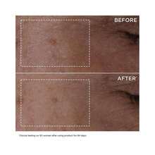 Clarins DOUBLE SERUM® To Firm, Smooth, Boost Radiance & Refine Pores |  | Serums & Facial Treatment - mặc định - Xem 3