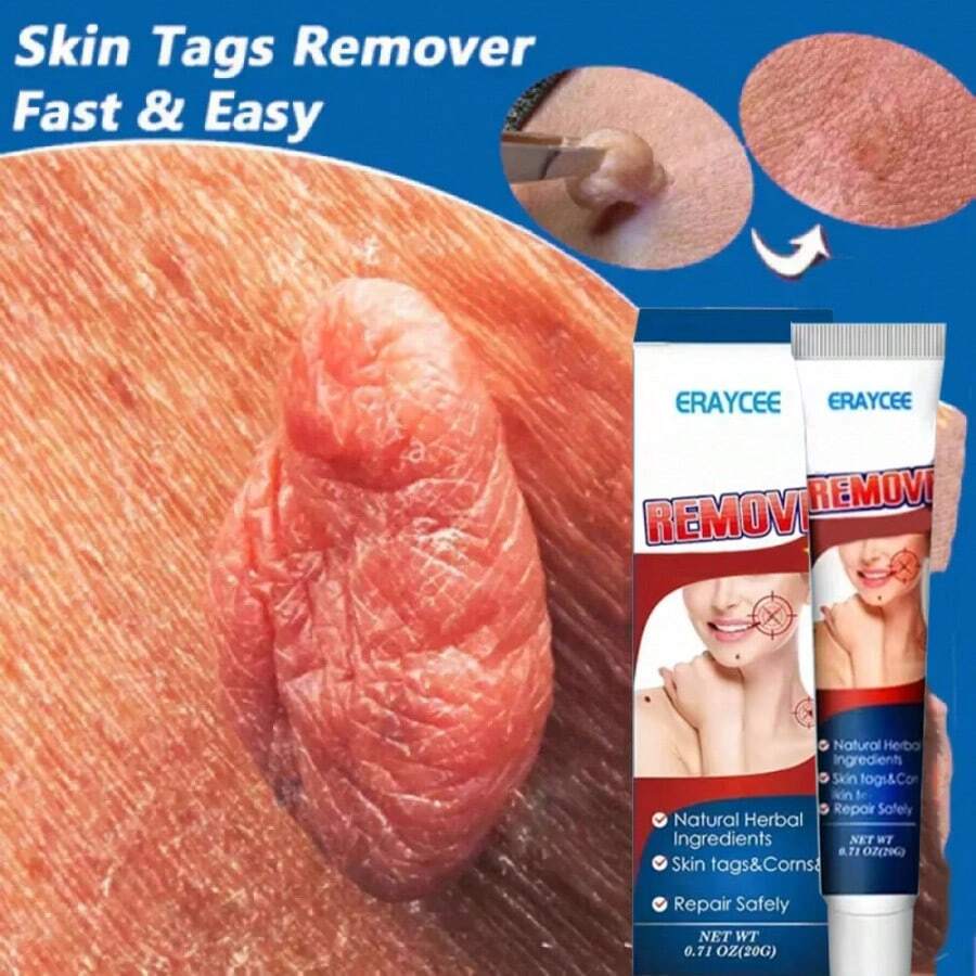 Bolígrafo portátil y ligero de luz azul de caliente para el cuidado suave de la piel y herramientas de tratamiento de verrugas domésticas - 1 unidad - Ver 1