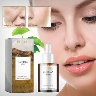 Centella Asiatica Facial Serum, Moisturizing, Improves Dry Skin, Smooths And Softens Skin, Brightens, Hydrates, Suitable For All Skin Types, Women, Holiday Gift,Centella Skin Care