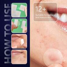 12/24pcs New Micro-Needle Scar Body Scar, Mole Cover Patches, Thinner & More Natural Coverage Patches, No Irritating Ingredients, Suitable For Multiple Skin Types, Gentle Formula, Unisex - Multicolor - View 5