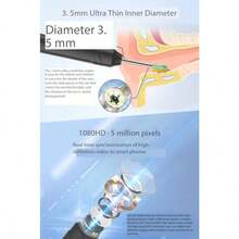 GSYY Wires Scope With 1080P FHD Resolun And LED Ligs For Ear  Removal Mini Sual Ear Inecn Camera With 3mm Silicone Ear Pick For Adul Pe W Connectity For Real-Time Mon And Recording In He Or Veterinary Use - Beige - View 5