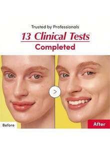 1 瓶维生素亮肤精华液，富含维生素 C 和烟酰胺，强化皮肤屏障，利用神经酰胺和透明质酸保湿，容量 30 毫升（1.01 液体盎司）。 - 金色 - 查看 5