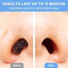 GSYY 60 Pcs Hair Ing Applica With Diosable Ats For Nostril Cleaning Ear And Face Hair Removal Pains Nose Applica Sticks For Men And Wen Ideal For Sensitive Areas Hienic And Ea To Use - 米色 - 查看 6