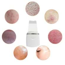 Electric Ultrasonic Skin Scrubber Deep Face Cleaning Machine Peeling Shovel Facial Pore Cleaner Face Skin Scrubber Machine 350mAh