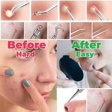 8PCS Blackhead Remover Comedone Extractor, Curved Blackhead Tweezers Kit, Professional Stainless Pimple Acne Blemish Removal Tools Kit For Manual - Silver - View 7