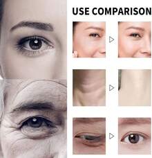 Crema Facial , Crema Removedora De Arrugas Qinglin Pa 5pcs - Champán - Ver 2