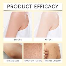 Bee Venoms Face, Neck & Body Care Cream - Natural Formula For Moisturizing & Smoothing Skin, Helps Improve Skin Texture And Support Skin Elasticity, Nourishing Ingredients Suitable For All Skin Types, Daily Skincare Essential - Màu vàng - Xem 9