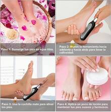 Lima para Pies de Acero Inoxidable – Removedor de Callos para Pies, Kit de Pedicura Profesional, Lija para Pies, Quíta Callos Pies, Kit Pedicure Spa en Casa - SG - Ver 7