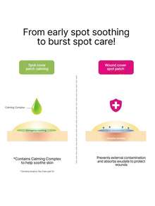 Olive Young 2 Packs Of Care Plus 96pcs Acne Pimple Patches, Suitable For Face And Body - Fast Acting, Vegan And Cruelty-Free, Korean Skincare, Korean Beauty Gift, Korean Cosmetics - 96 sheets Two packs - 查看 10