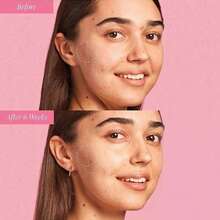 Watermelon Niacinamide Dew Drops - Brightening, Plumping Hydrating Face Serum, Makeup Primer + Liquid Highlighter With Hyaluronic Acid - Dewy & Glowing Korean Skin Care (40ml) - Nhiều màu - Xem 3