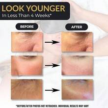 Mascarilla Para Dormir De Seda Antienvejecimiento Para Mujer, Mscara De Ojos De Seda Morera Para Dormir Y Cuidado De La Piel, Mscara Opaca Para Dormir Con Tec - Oro rosa - Ver 4