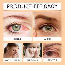 Honey Eye Drops 30ml, Eye Drops For Dry Eyes, Instant Relief For Dryness & Fatigue, Hydrating & Soothing Eye Care, Long-Lasting Moisture, Free Shipping,Christmas Gifts,Christmas,Stocking Stuffers - 橘色 - 查看 2