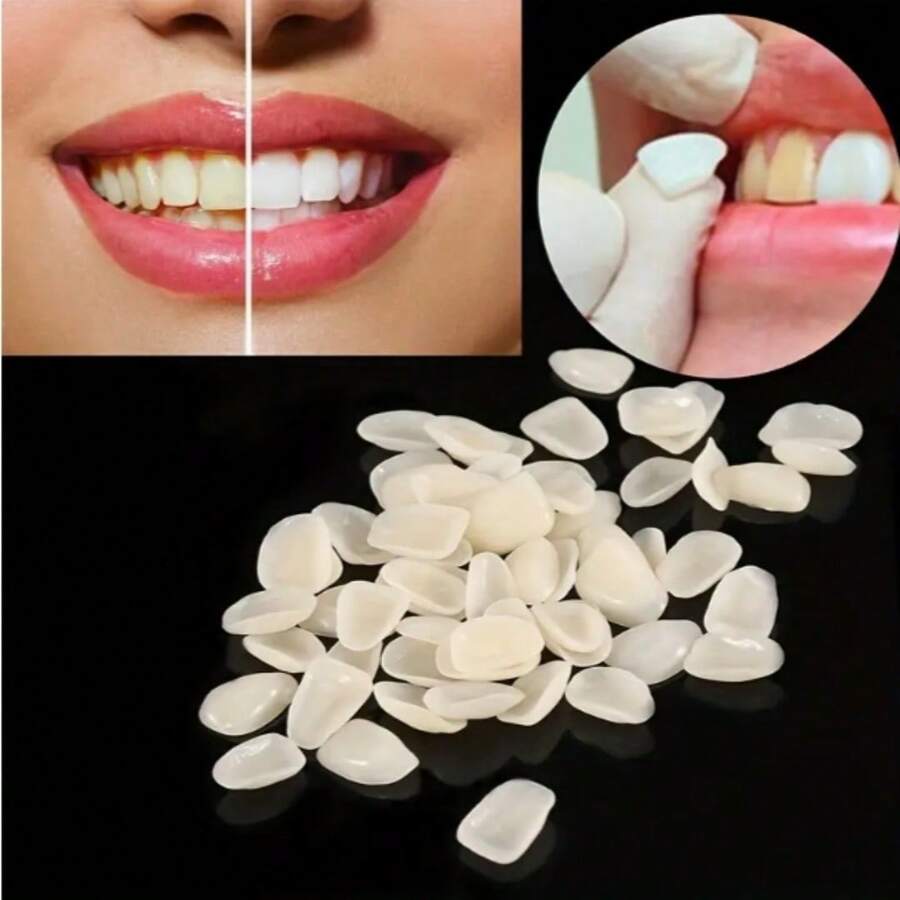 Kit de reemplazo temporal de dientes, tiras blanqueadoras de dientes, simple y conveniente, adecuado para todas las formas de dientes, aumenta la confianza y el encanto de la sonrisa - Multicolor - Ver 1