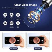 1pcs Smart Visual Ear Scoop Family Set, Ear Wax Removal Camera, Ear Cleaner HD Camera, Ear Cleaning Kit With 8pcs Ear Set, Wireless WiFi Otoscope With 6 Lights, Rechargeable Earwax Removal Tool Kit - Black - View 6