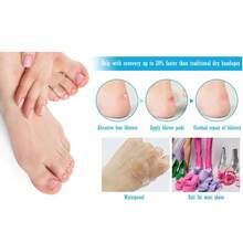 Băng dán phồng rộp, miếng dán phồng rộp (30 miếng), miếng dán gel phồng rộp, miếng dán phồng rộp, băng keo hydrocolloid, thích hợp để ngăn ngừa và chữa lành phồng rộp ở ngón tay, ngón chân và gót chân, không thấm nước, siêu mỏng - Nhiều màu - Xem 8
