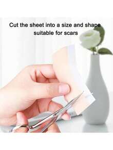 1roll Silicone Scar Patch Skin SheetsPatch - Yellow - View 5