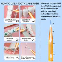 Nettoyage interdentaire, 1 sac SUPER DEER 0,7 mm Sac orange Brosses pour appareils dentaires, 10 brosses/sac, Brosse interdentaire en forme de I, Poils en nylon doux, Tête de brosse extensible pour prévenir la croissance bactérienne, Emballé individuellement, Tête de fil dentaire, Outil de nettoyage dentaire facile à utiliser