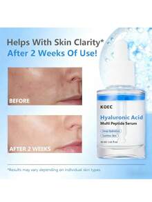 KOEC Hyaluronic Multi Peptide PDRN Serum For Glowing And Soothing | Lightweight Water Plumping Radiant Facial Serum For All Skin Type, Hydrating Moisturizer, Korean Skincare | 30ml 1.01fl.Oz - Nhiều màu - Xem 3