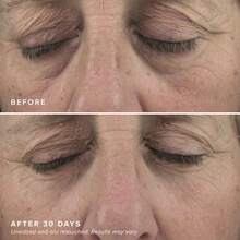 TYUI DRMTLGY Brightening Eye Masks 30 Pairs - Caffeine Eye Masks For Dark Circles And Puffiness With Hyaluronic Acid Eye Patches For Puffy Eyes - Gói 60 chiếc của 1 - Xem 5