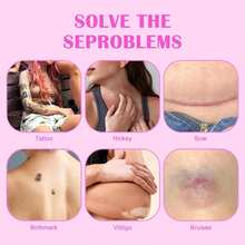 3Pcs Tattoo Cover Up Patchs, Waterproof Ultra Thin Scar Patch, Tattoo Cover Up Invisible Sweatproof Concealer Sticker, Breathable, Scar, Birthmarks, Dark Spots - Yellow - View 4