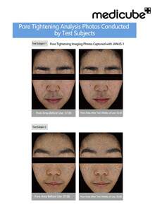 Medicube Miếng tẩy trang Zero Pore Pads 2.0 (70 miếng), Miếng tẩy trang chứa axit salicylic giúp thu nhỏ lỗ chân lông và chăm sóc lỗ chân lông với 4,5% axit lactic AHA và 0,45% axit salicylic BHA, lý tưởng cho mọi loại da, Chăm sóc da Hàn Quốc - Miếng lót Zero Pore Pads 2.0 70 miếng - Xem 3