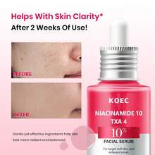 KOEC 10%烟酰胺+4%氨甲环酸面部精华液，提升肌肤光泽，改善肤色不均，令肌肤光滑细腻。 - 淺粉色 - 查看 5