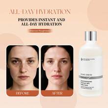Nước hoa hồng dưỡng da 100ml sữa lên men 30% - Kem dưỡng da - Xem 4