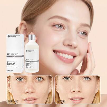 Nước hoa hồng dưỡng da 100ml sữa lên men 30%