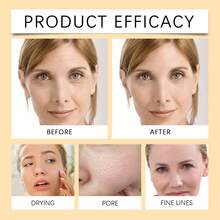 Lemon Turmeric Brightening Soap, Gentle Cleansing, Moisturizing, Hydrating Facial & Body Care Bar - Orange White - View 9