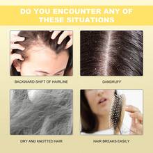 Yellow Hair Care Oil Capsules, Repair Scalp, Dandruff Removal, Nourish Hair, Soft & Shiny - Yellow - View 4